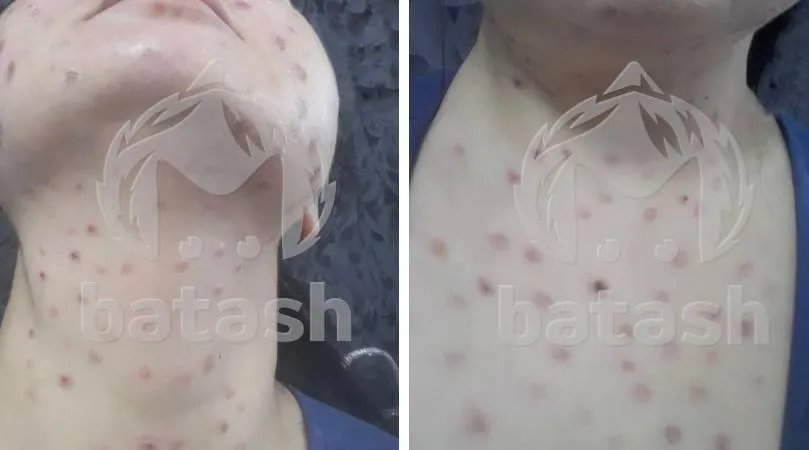 Уфимка сходила на омолаживающие процедуры и теперь каждый месяц платит по 30 тысяч за лечение. Фото: @t.me/mash_batash
