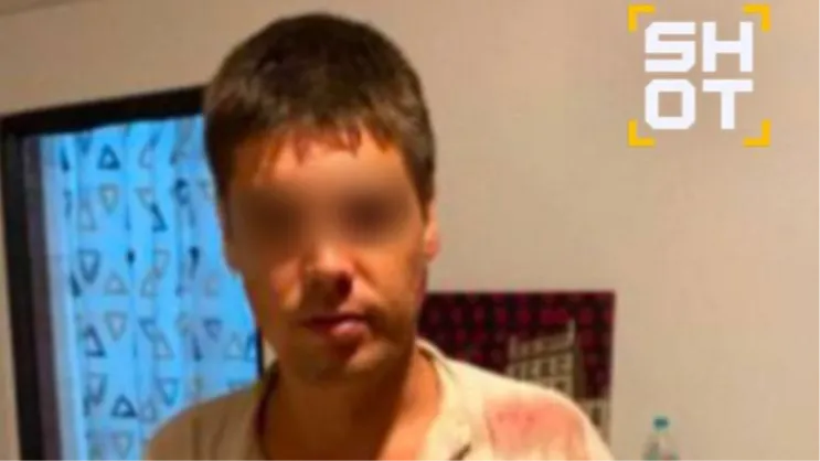 В Индии мужчины с мачете напали на российских туристов, мужчине порезали лицо. Фото: @shot_shot