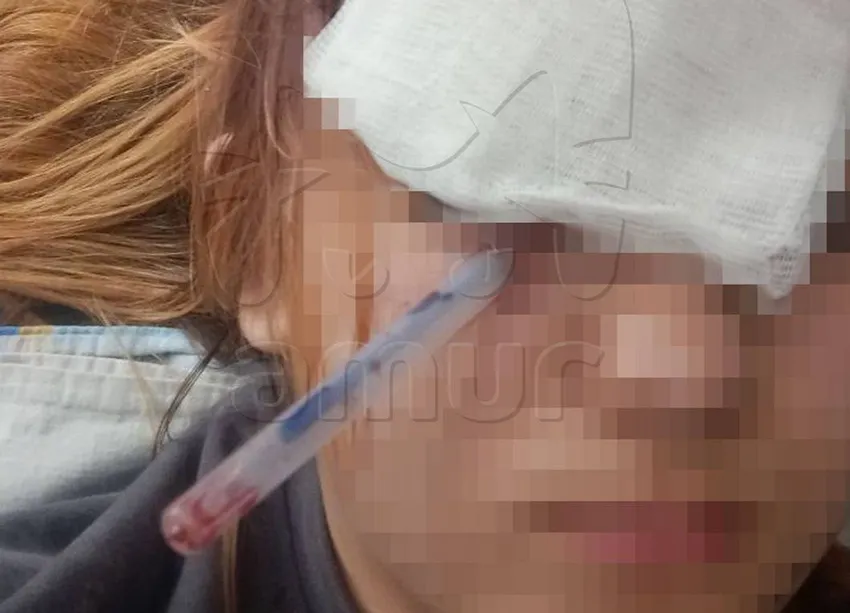 В Приморье школьник воткнул ручку в глаз девочки, которая дала ему подзатыльник. Фото: t.me/amur_mash