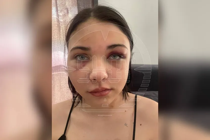 В Башкирии компания местных гопниц поставила 14-летнюю школьницу "на счетчик" и избила за сломанный телефон. Фото: t.me/shot_shot