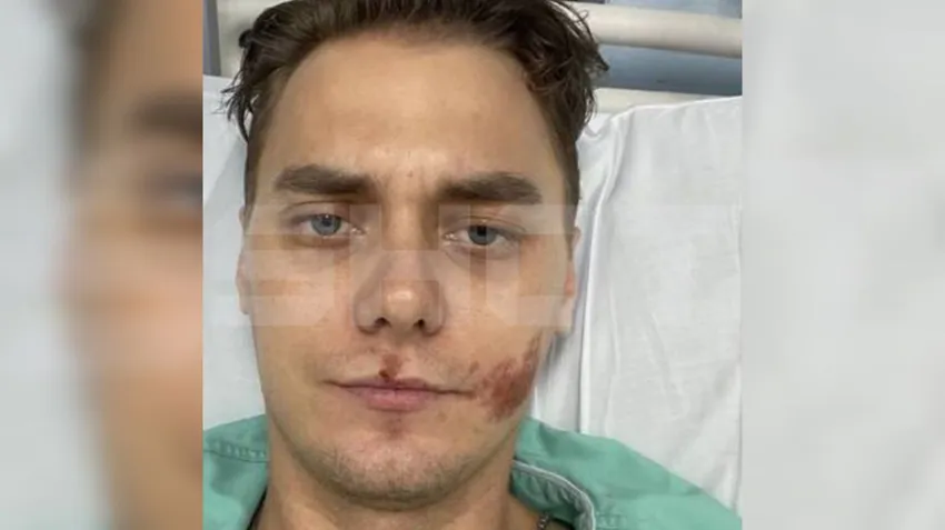 В Таиланде парень из России получил перелом бедра, попав в ДТП на мотоцикле. Фото: t.me/shot_shot