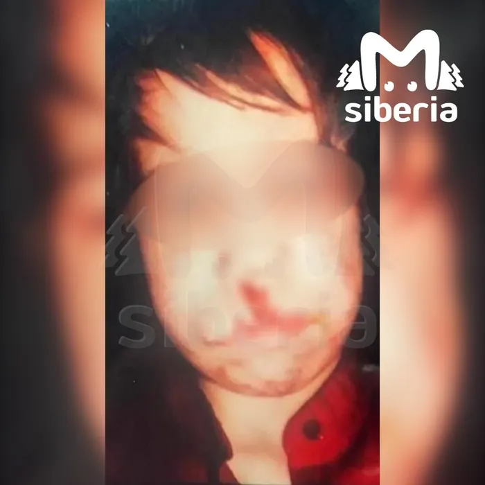 12-летний мальчик выглядел просто ужасно, когда его нашли. Фото: t.me/mash_siberia