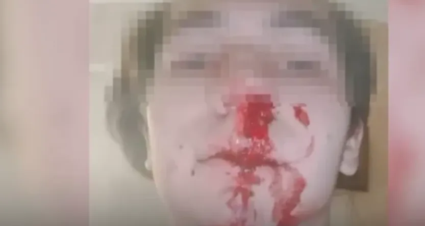 Хулиганов, избивших 15-летнего мальчика-сироту из-за длинных волос, нашли. ФОТО: @T.ME/URL_MASH