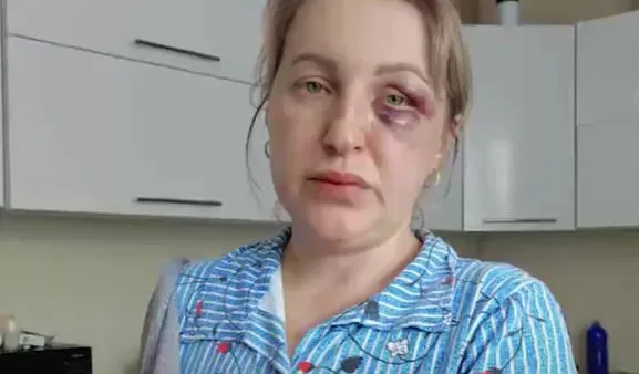 Мужа, который оторвал жене ухо и сжег дом из-за развода, не накажут по закону. Фото: t.me/url_mash