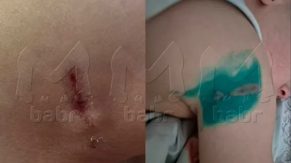 Под Иркутском дворняга без причины напала на 3-летнего ребенка с матерью. Фото: t.me/babr_mash