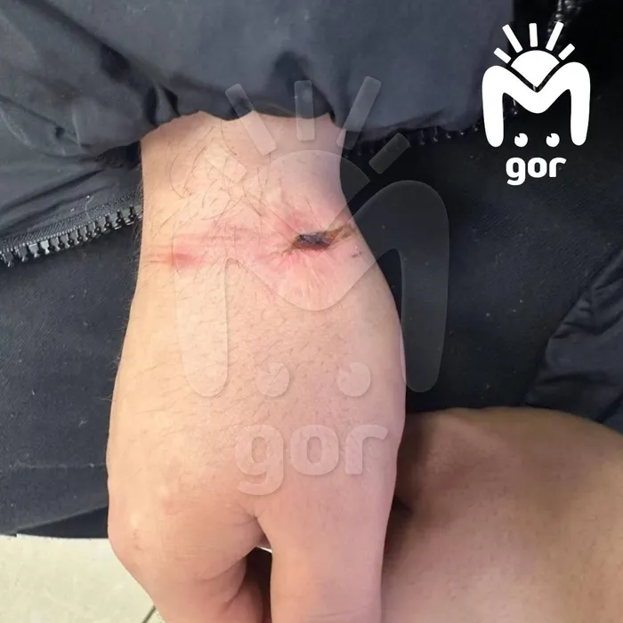 В Подмосковье парень обвинил полицейских в том, что они изнасиловали его шваброй. Фото: t.me/mash_gor