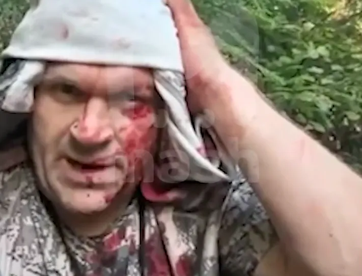 Под Нижним охотник в лесу столкнулся с медведицей, чудом отбился и выжил. Фото: @breakingmash