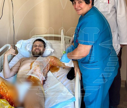 Грузинские медики были в шоке оттого, что парень выжил после такого удара. Фото:t.me/shot_shot