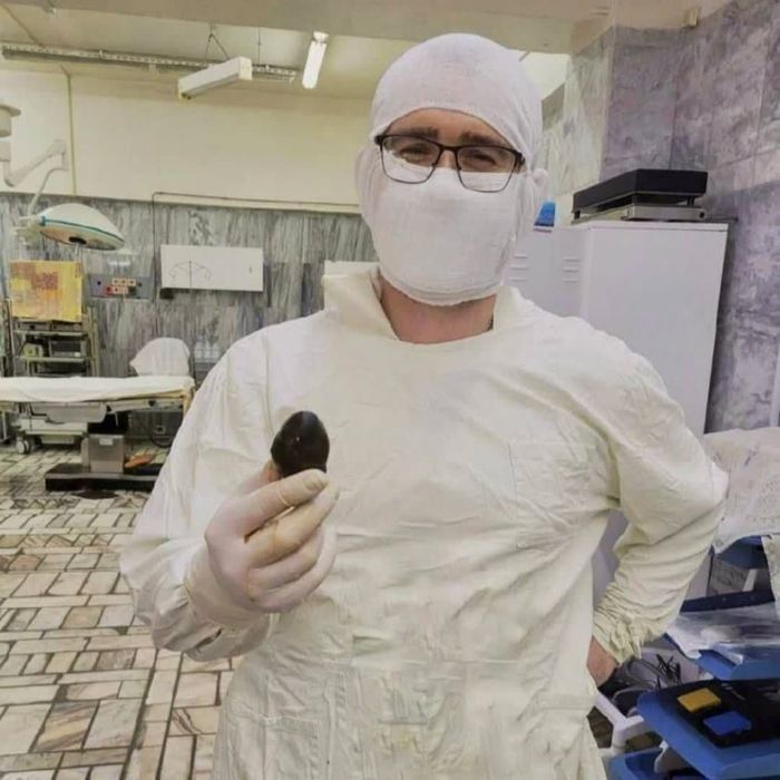 Доктора сильно удивились, когда нашли такой "экспонат" в организме пациентки. Фото: @t.me/mash_siberia