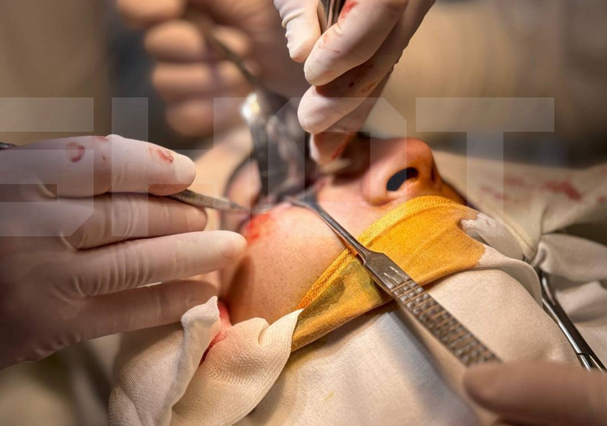 В Подмосковье парень 10 дней смотрел на себя изнутри из-за травмы глазницы. Фото: t.me/shot_shot