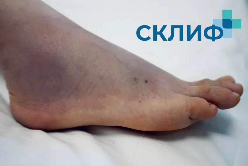 Фото: t.me/sklifofficial