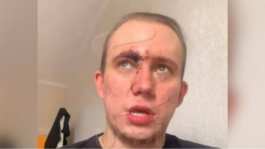 Челябинскому музыканту разбили лицо в ночном клубе прямо в день рождения за то, что он заступился за подругу. Фото: @t.me/url_mash