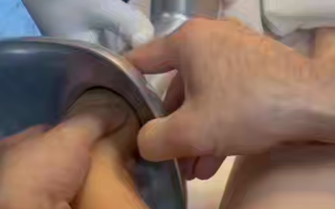 В Ингушетии врачи спасли 3-летнюю девочку, которая сунула руку в мясорубку. Фото: t.me/mash_gor