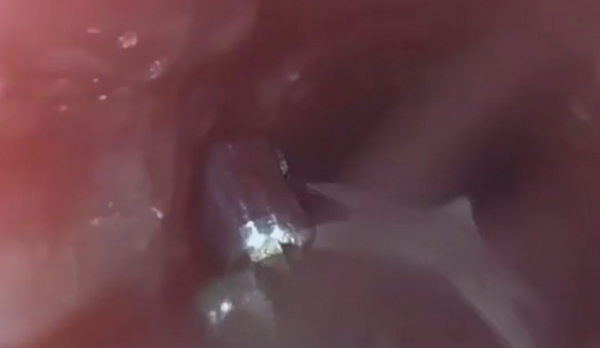 В Москве годовалый малыш чуть не задохнулся, проглотив наклейку от яблока. Фото: @breakingmash