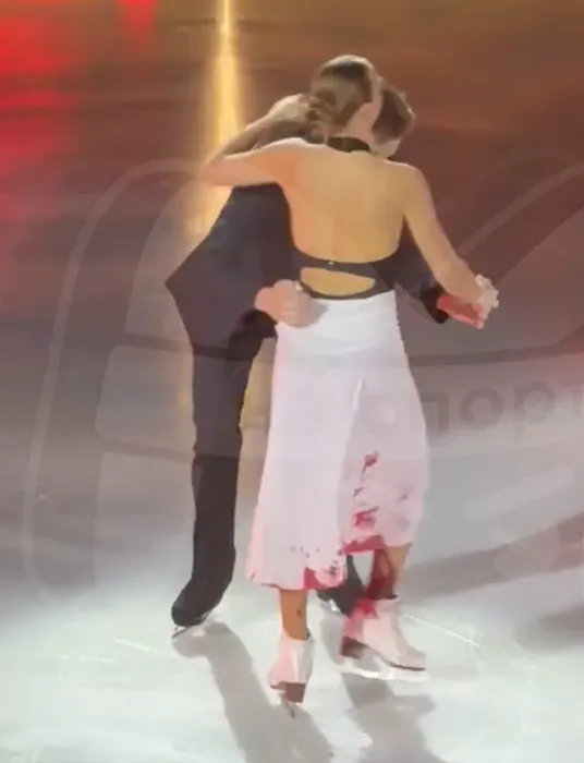 Рана от пореза сразу стала сильно кровоточить. ФОТО: соцсети