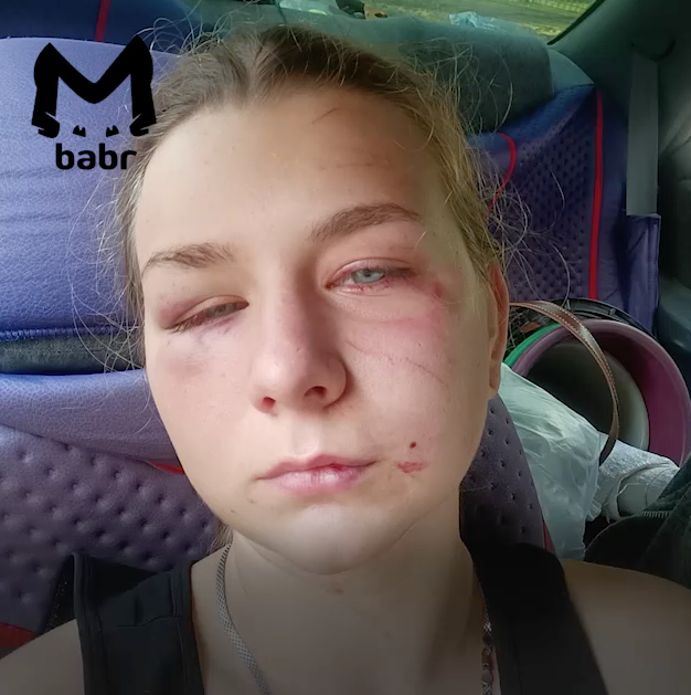 19-летняя пострадавшая Александра Агеева. Фото: @babr_mash