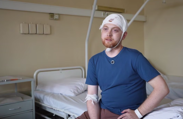 В Склифе врачи удалили из мозга пациента опухоль, выросшую до размеров кулака. Фото: t.me/dzdmos