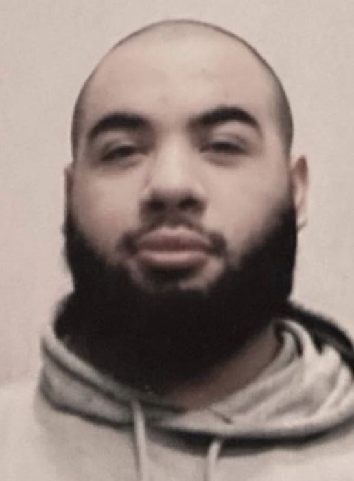 Таким Руди был до вмешательства хирургов. Фото: Инстаграм (запрещён в РФ) / @rudyvmua_