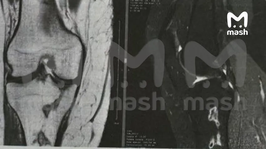 Фото: @breakingmash