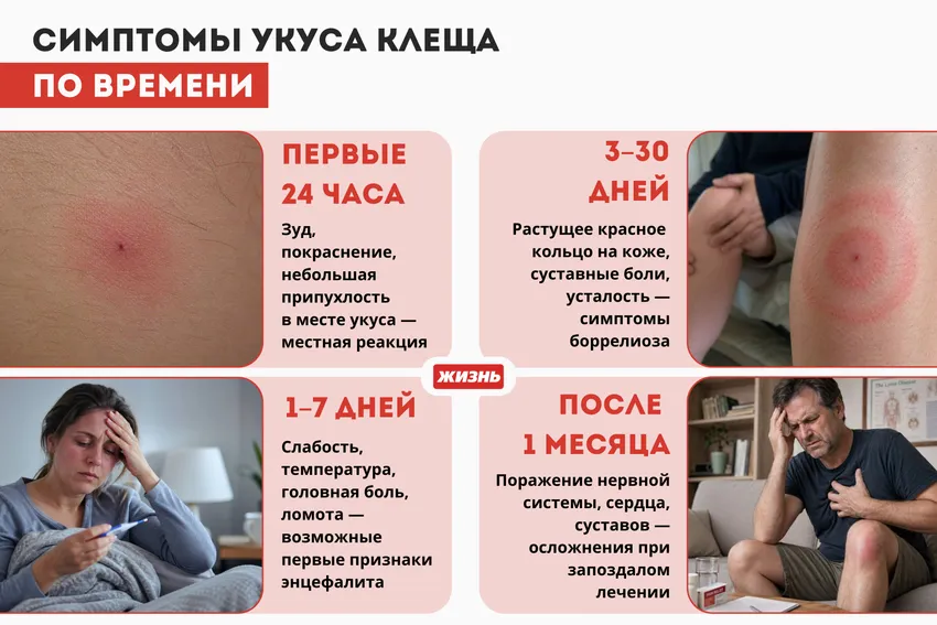 Симптомы укуса клеща (фото). Коллаж: Гавришева Анна