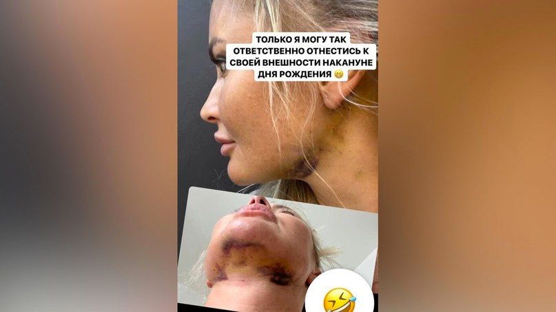 Фото: Инстаграм (запрещён в РФ) / @danaborisova_official
