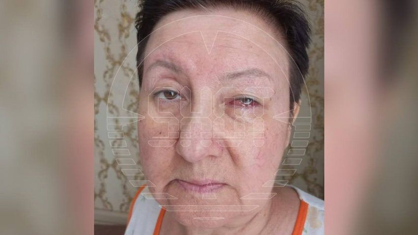 В Уфе пациентка заплатила 100 тысяч за операцию по удалению катаракты и ослепла. Фото: @t.me/shot_shot