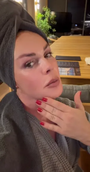 Екатерина Андреева и ее процедуры по омоложению. ФОТО: соцсети