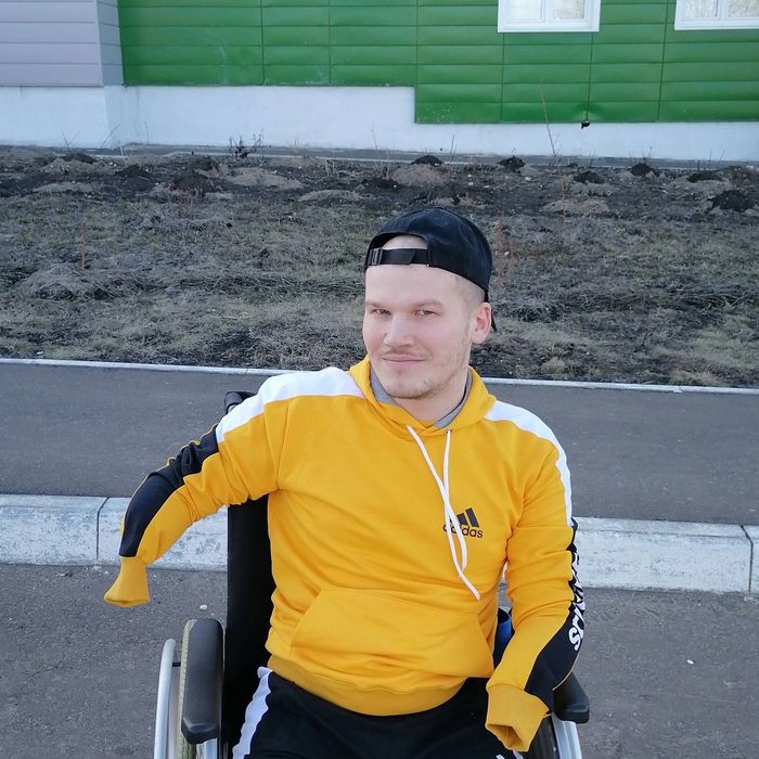 Игорь до протезов. Фото: личный архив