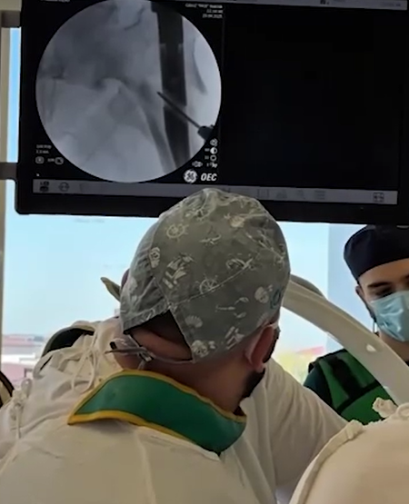 Момент операции. ФОТО: t.me/mash_gor