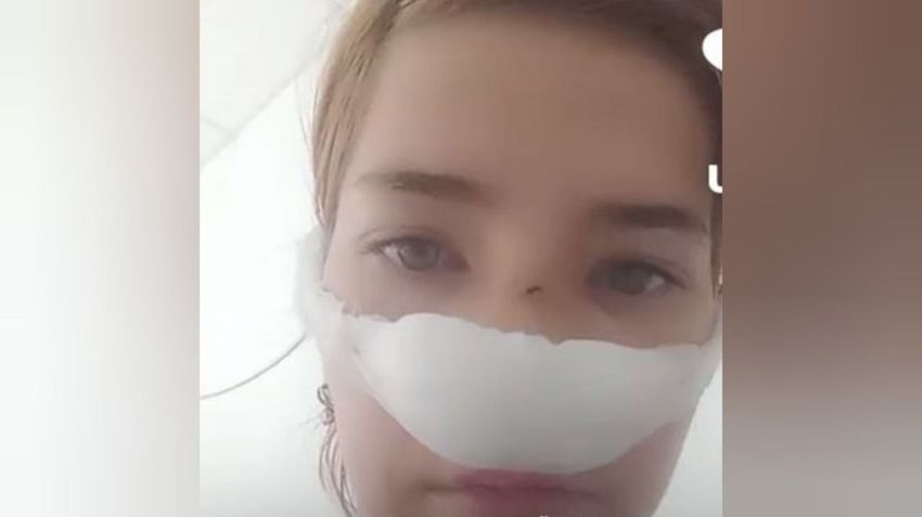 Пострадавшая Елена. Фото: @t.me/url_mash