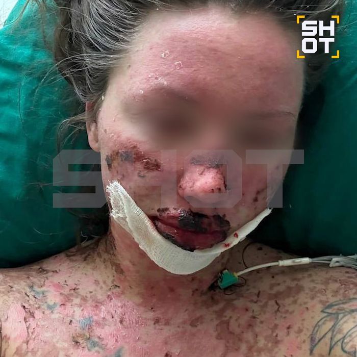 Фото: t.me/shot_shot