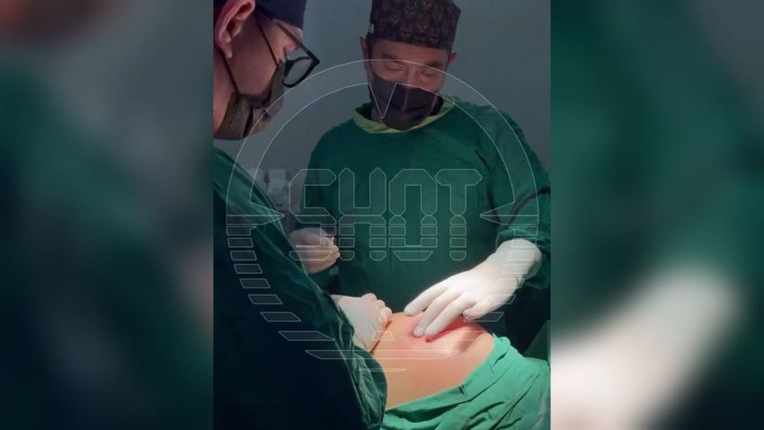 В Подмосковье врачи удалили 2 литра гноя из ягодиц пациентки из-за неудачной пластической операции. Фото: @T.ME/SHOT_SHOT