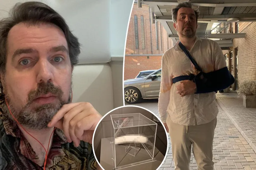 Британец с «самым большим в мире пенисом» сломал из-за него руку в душе. Фото: nypost.com