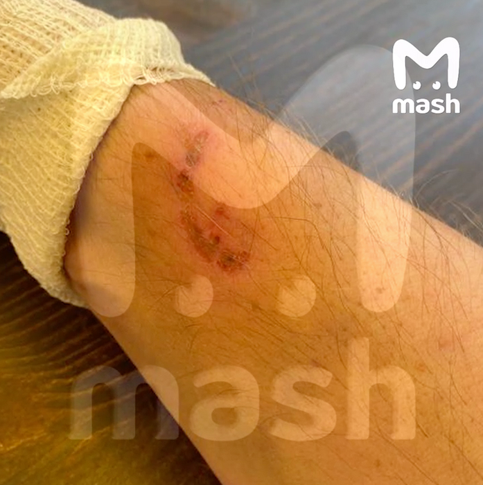 Фото: @breakingmash