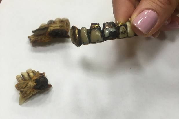 ФСБ РФ достали из личного архива разломанную челюсть Адольфа Гитлера. Фото: t.me/shot_shot