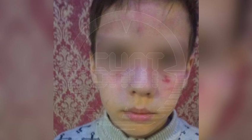 В Калужской области отец с сыном "по ошибке" жестоко избили соседского ребенка и изрезали собаку. Фото: t.me/shot_shot