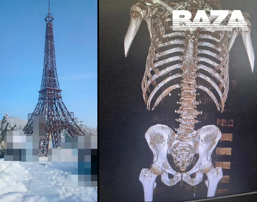 Под Саратовом мужчина упал с копии Эйфелевой башни - у него переломаны ребра. Фото: t.me/bazabazon