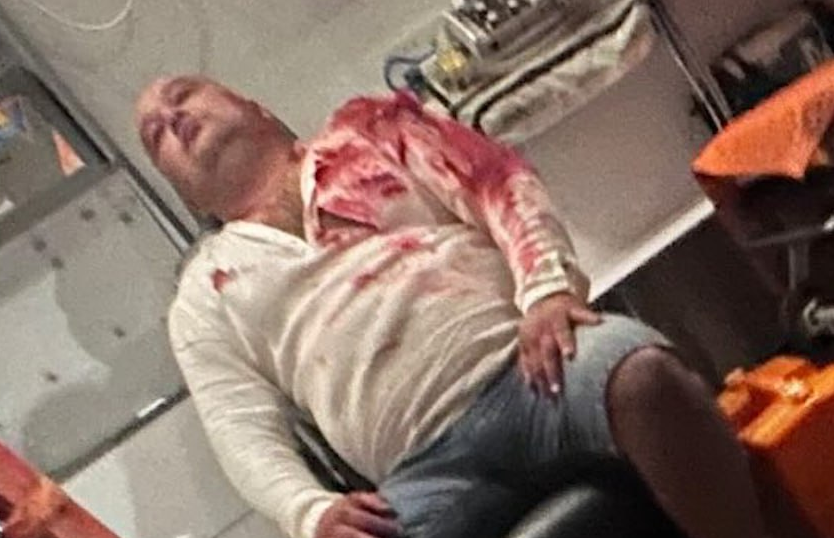 В Башкирии на съемках клипа местной певицы медведь напал съемочную группу. Фото: t.me/mash_batash