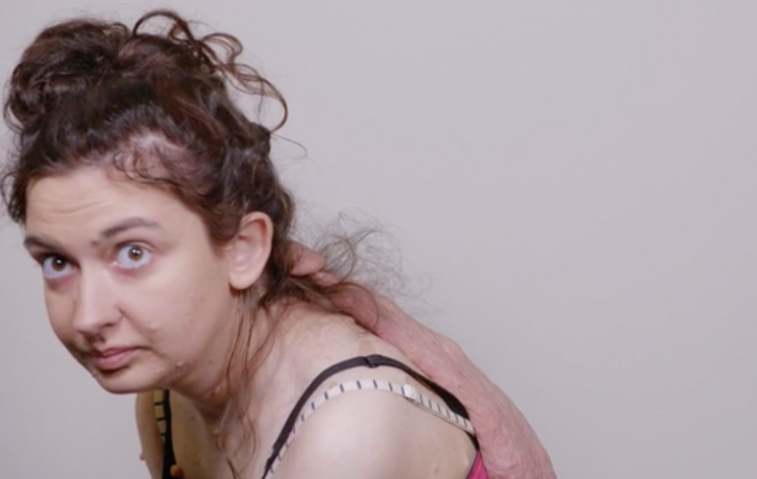 Ни один немецкий врач не соглашался делать операцию девушке. Фото: dailymail.co.uk