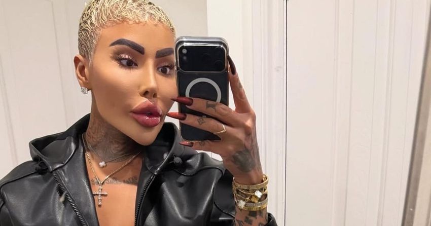 «Король губ», хотевший стать Ким Кардашьян, умер после неудачной бьюти-процедуры. Фото: соцсети