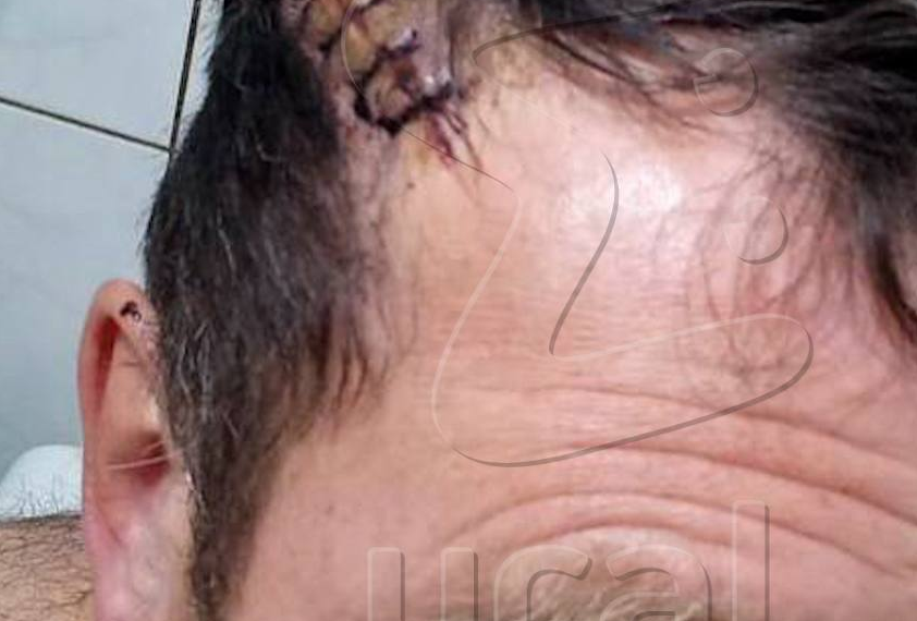 На Урале мужчина проломил соседу голову ломом за просьбу не воровать у него воду. Фото: t.me/url_mash