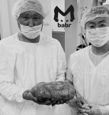 Бурятские хирурги провели идеальную операцию. ФОТО: t.me/babr_mash