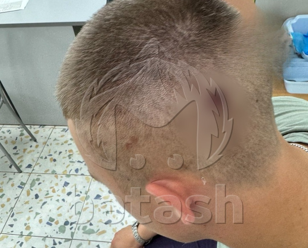 В Уфе 17-летний парень получил пулю в голову, работая охранником ночного клуба. Фото: t.me/mash_batash