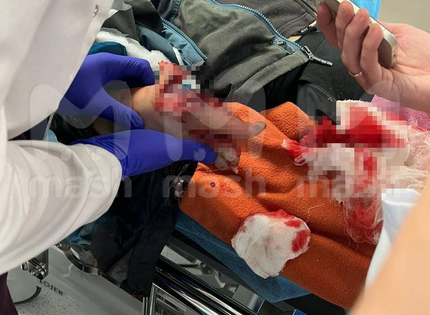 10-летнему мальчику, который поднял СВУ в Красногорске, оторвало пальцы взрывом. Фото: @breakingmash