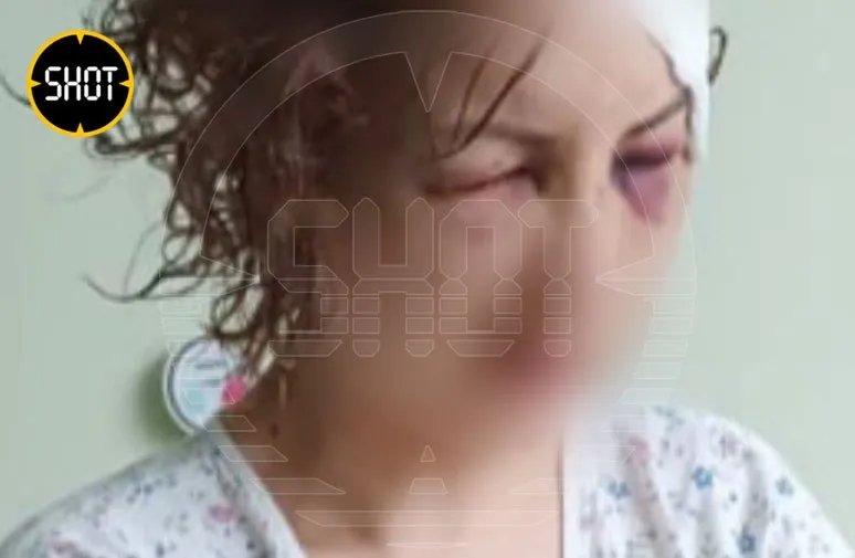 Избитая София. Фото: @t.me/shot_shot