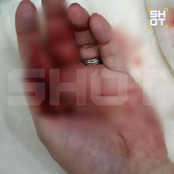 Фото: t.me/shot_shot