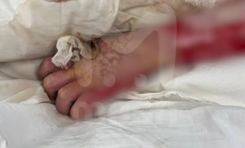 В Питере девушка попала в реанимацию после того, как купила вейп в переходе. Фото: @breakingmash