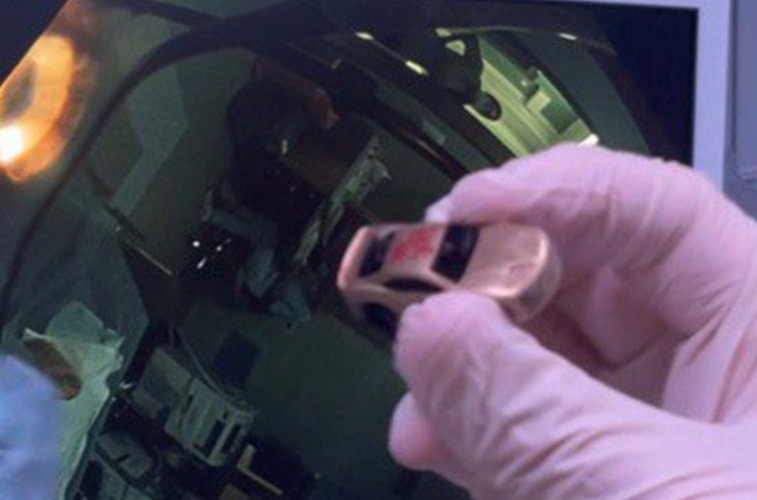 В Москве врачи достали машинку, «припаркованную» в желудке 5-летнего мальчика. Фото: mz.mosreg.ru