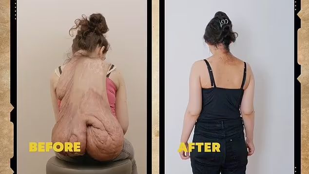 Немка после операции была невероятно счастлива - она чувствует себя свободной и красивой, как принцесса. Фото: dailymail.co.uk