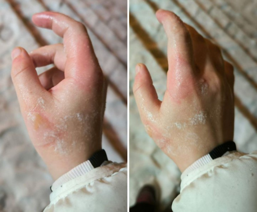 В Питере школьница обожглась маслом на кулинарном мастер-классе за 18 тысяч. Фото: t.me/mashmoyka